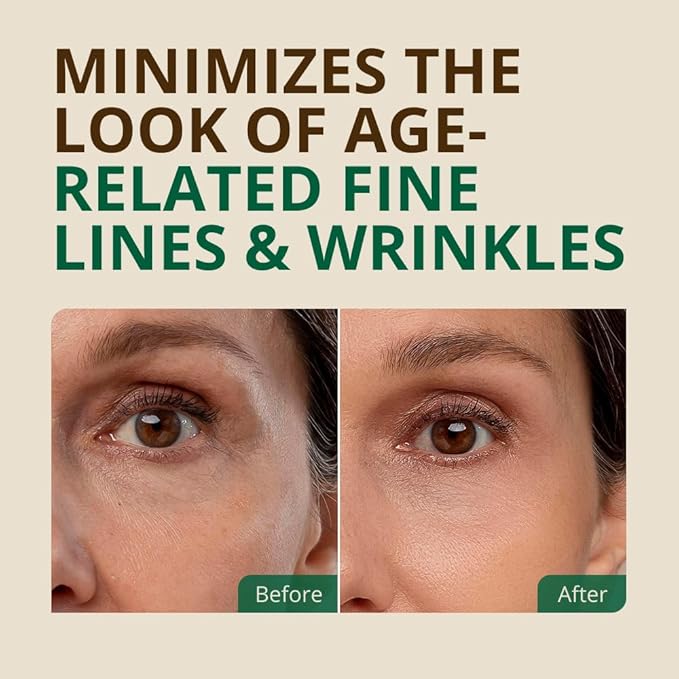 Vitamin E Oil - 100% All Natural & USDA Organic (LARGE 4oz Bottle) Repair Dry, Damaged Skin from Surgery & Acne, Age Spots. For Radiant, Hydrated & Youthful Skin. Face & Body Moisturizer