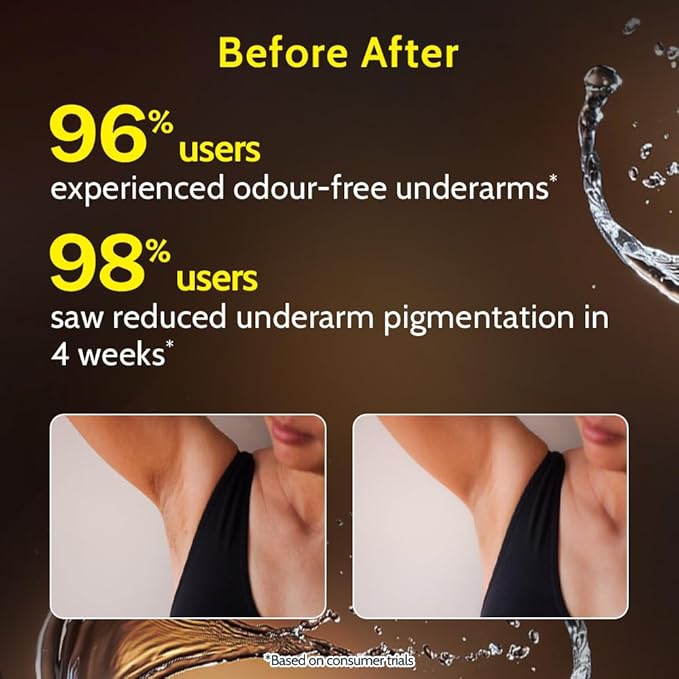 Chemist at Play UnderArm Roll-On with 5% AHA|Lactic & Mandelic Acid|Prevents Odour, Brightens Skin & Exfoliates Underarm|For Sensitive Skin |Woody Musk Fragrance |Alcohol & Aluminium Free | 1.35 fl oz